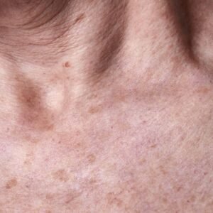 Barrido facial