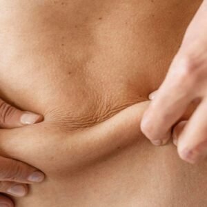 Mesoterapia corporal en Sabadell resultado