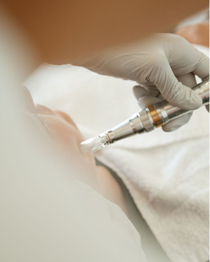 Microneedling tratamiento regeneración cutánea Sabadell